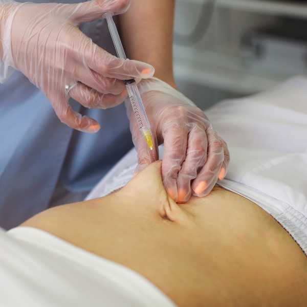 Aqualyx Fat Injections