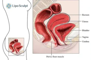 Treatment For A Leaky Bladder 2 How EM Chair treatment Chard can help Leaky bladder issues. Read more now!